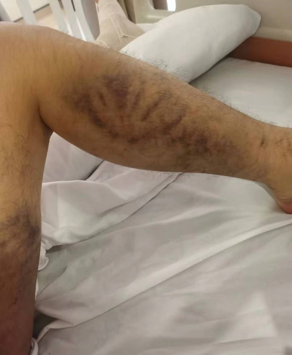 西港永利园区从事非法快递诈骗和人口贩卖  第3张