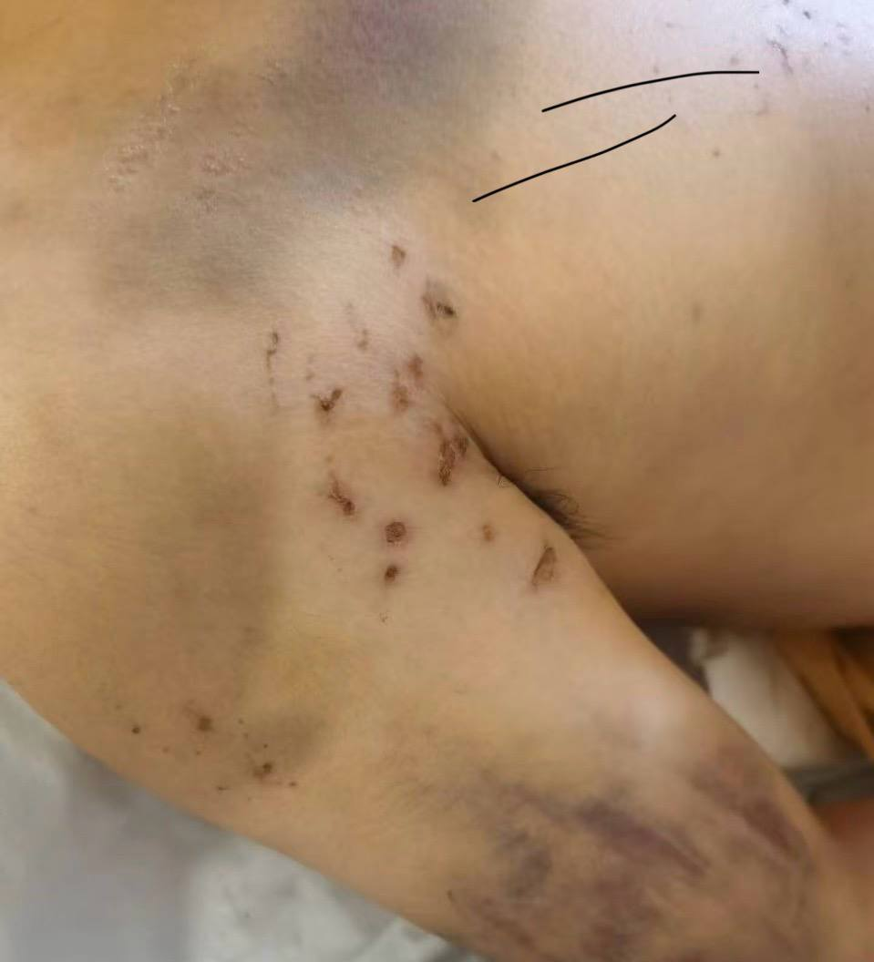 西港永利园区从事非法快递诈骗和人口贩卖  第4张